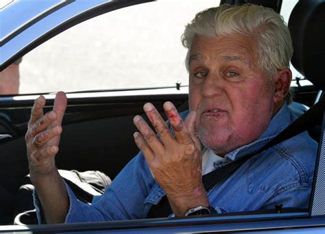 Jay Leno attends the Hand in Hand: A Benefit for Hurricane Harvey Relief in Los Angeles on Sept. 12, 2017. Jay Leno suffered burns in a weekend fire at the car enthusiast's garage but said Monday ...